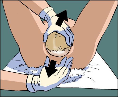 Роды от подготовки до послеродового периода. Лечебно-тактические мероприятия для работников СиНМП 04 Роды от подготовки до послеродового периода. Лечебно-тактические мероприятия для работников СиНМП 04