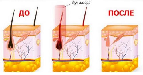 С какой периодичностью делать лазерную эпиляцию. Сколько сеансов лазерной эпиляции нужно для разных участков тела? 01 С какой периодичностью делать лазерную эпиляцию. Сколько сеансов лазерной эпиляции нужно для разных участков тела? 01