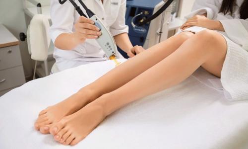 После лазерной эпиляции: время, когда волосы начинают вырастать снова 05 После лазерной эпиляции: время, когда волосы начинают вырастать снова 05