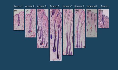 Как часто нужно проводить процедуры лазерной эпиляции, чтобы достичь максимального эффекта. Анаген
