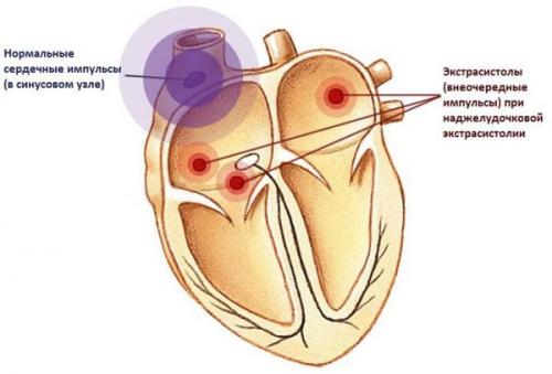 Как употребление кофе связано с аритмиями. Ученые опровергли миф о кофе и аритмии 02 Как употребление кофе связано с аритмиями. Ученые опровергли миф о кофе и аритмии 02