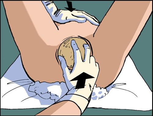 Как вести себя во время родов и схваток правильно. Схватки и роды - стоит ли их бояться? Как облегчить боль при схватках? 04