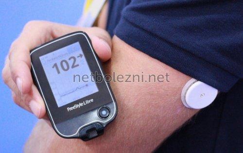 Измерение уровня сахара в крови. МАТЕРИАЛЫ И МЕТОДЫ 04