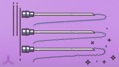 Мезонити для подтяжки. Какие виды мезонитей бывают 01