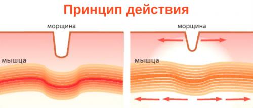 Вреден ли ботокс для лица. Косметические процедуры 03 Вреден ли ботокс для лица. Косметические процедуры 03