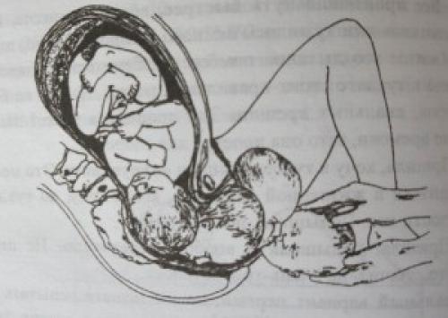 Дыхание при родах форум. Дыхание в родах