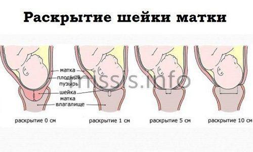 Как распознать схватки при первых родах. Ощущения при истинных схватках у первородящих 01 Как распознать схватки при первых родах. Ощущения при истинных схватках у первородящих 01
