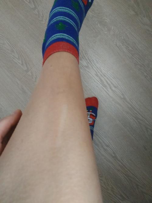 Побрилась в день лазерной эпиляции форум. Лазерная эпиляция. Мой опыт. Нужны советы