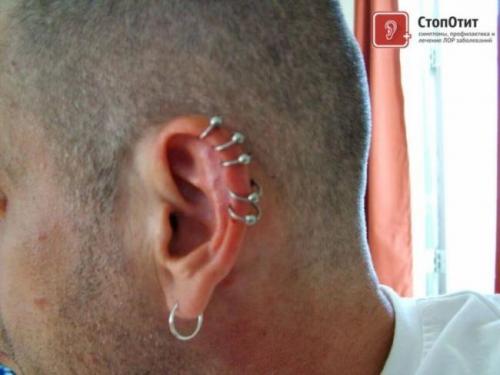 Прокол козелка для похудения. Что такое сережка для похудения 01 Прокол козелка для похудения. Что такое сережка для похудения 01