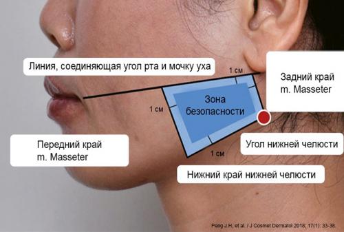 Коррекция формы нижней трети лица с помощью ботулинотерапии. Контурная пластика нижней трети лица 01 Коррекция формы нижней трети лица с помощью ботулинотерапии. Контурная пластика нижней трети лица 01