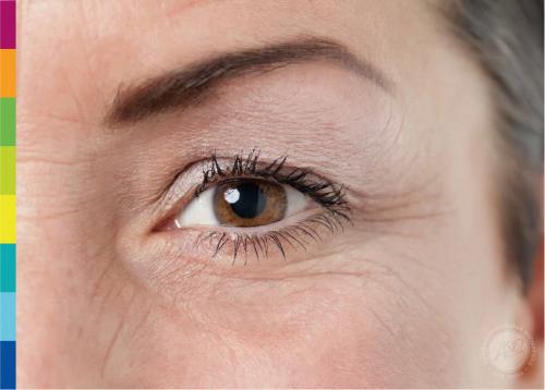 Появились морщины под глазами, что делать. Профессиональный уход за кожей — путь к избавлению от морщин 06 Появились морщины под глазами, что делать. Профессиональный уход за кожей — путь к избавлению от морщин 06