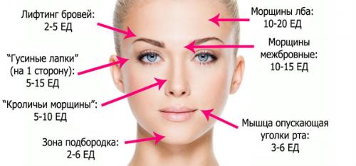 Ботокс рассасывается или нет. Можно ли пить алкоголь после инъекций Ботокса? 03 Ботокс рассасывается или нет. Можно ли пить алкоголь после инъекций Ботокса? 03