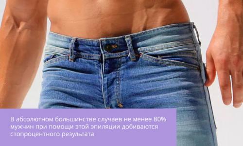 Как часто делать лазерную эпиляцию бикини.  Отличия лазерной эпиляции от фотоэпиляции и других видов эпиляции? 02