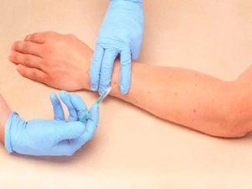 10 вопросов о ботулинотерапии. Ботулинотерапия: за и против 03