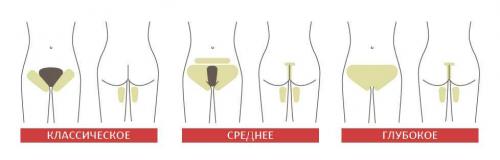 Подготовка к лазерной эпиляции глубокого бикини. Особенности удаления волос в интимной зоне