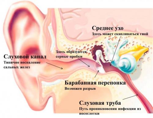 Зарастает ли хрящ в ухе.  Проведение операции по формированию ушной раковины из хрящевых тканей 06 Зарастает ли хрящ в ухе.  Проведение операции по формированию ушной раковины из хрящевых тканей 06