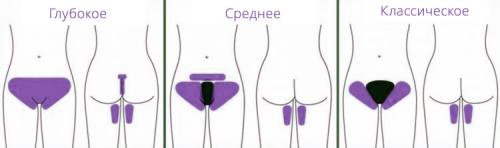 Баня после лазерной эпиляции. Чего нельзя делать после лазерной эпиляции 04 Баня после лазерной эпиляции. Чего нельзя делать после лазерной эпиляции 04