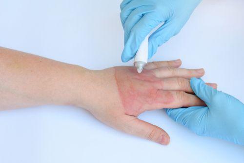 Убрать следы от прыщей на лице. Почему появляются следы от прыщей 01 Убрать следы от прыщей на лице. Почему появляются следы от прыщей 01