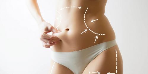 Альтернатива липосакции. Выбор оружия