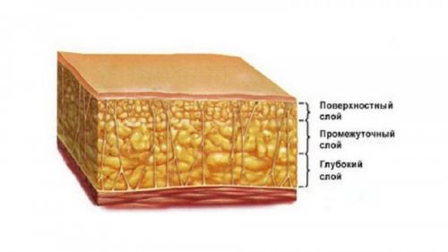 Какой метод удаления жира выбрать. Показания, ограничения, возможности 05