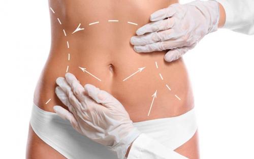 Какой метод удаления жира выбрать. Показания, ограничения, возможности 01