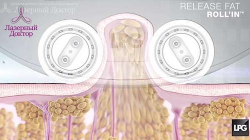Вакуумно-роликовый массаж тела и лица. Вакуумно-роликовый массаж: важные нюансы самой процедуры 01