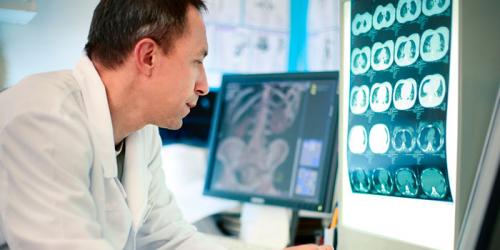 Скрининг рака легкого: преимущества, недостатки и новые рекомендации