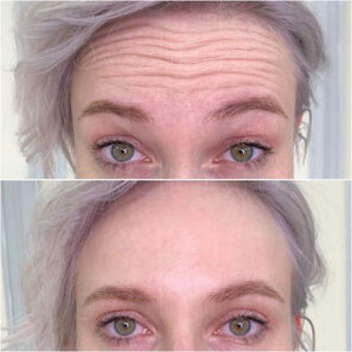 Боткс: открытие молодости или опасный эксперимент 03