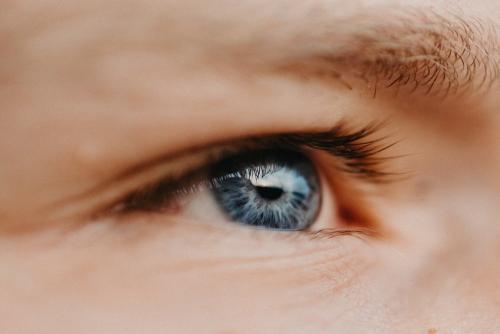 Как бороться с гусиными лапками вокруг глаз. Как убрать гусиные лапки вокруг глаз 06