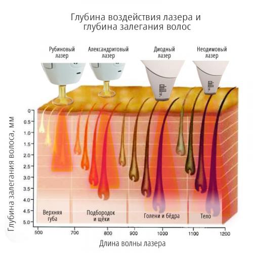Сколько процедур потребуется для достижения желаемого результата