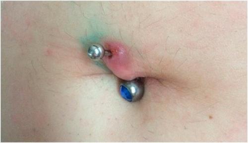 Зарастет ли септум если его не носить. Пирсинг септум 01 Зарастет ли септум если его не носить. Пирсинг септум 01