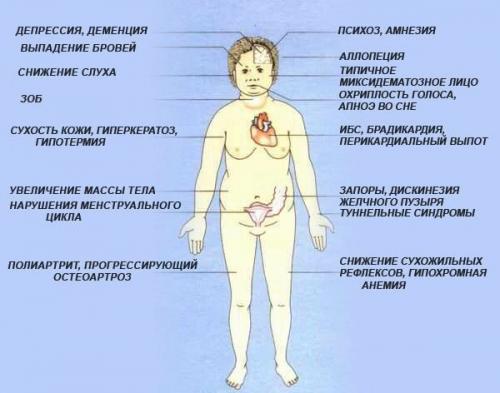 Какие симптомы нехватки йода в организме. Причины 01 Какие симптомы нехватки йода в организме. Причины 01