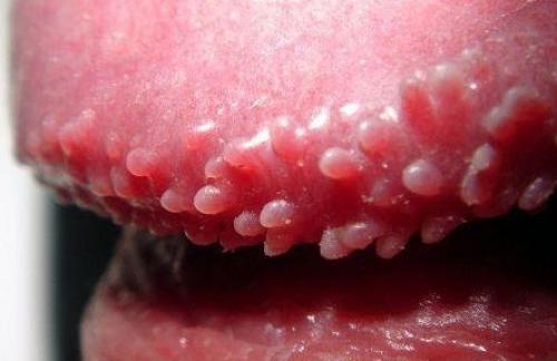 Папула это. Общие сведения