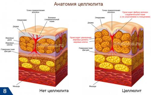 Lpg-массаж до и после. Оптимальные показания к LPG-массажу –