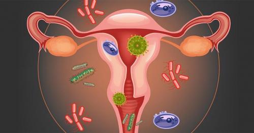 Какие основные причины женских заболеваний. Причины развития воспалительных процессов в женских половых органах