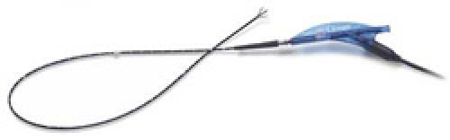 Метод радиочастотной абляции РЧА. Об операции РЧА 02 Метод радиочастотной абляции РЧА. Об операции РЧА 02