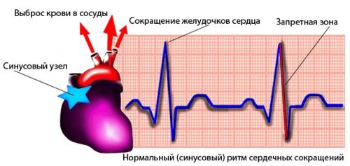 Что нельзя делать при аритмии сердца. Не норма   04 Что нельзя делать при аритмии сердца. Не норма   04